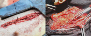 aberturacirurgia
